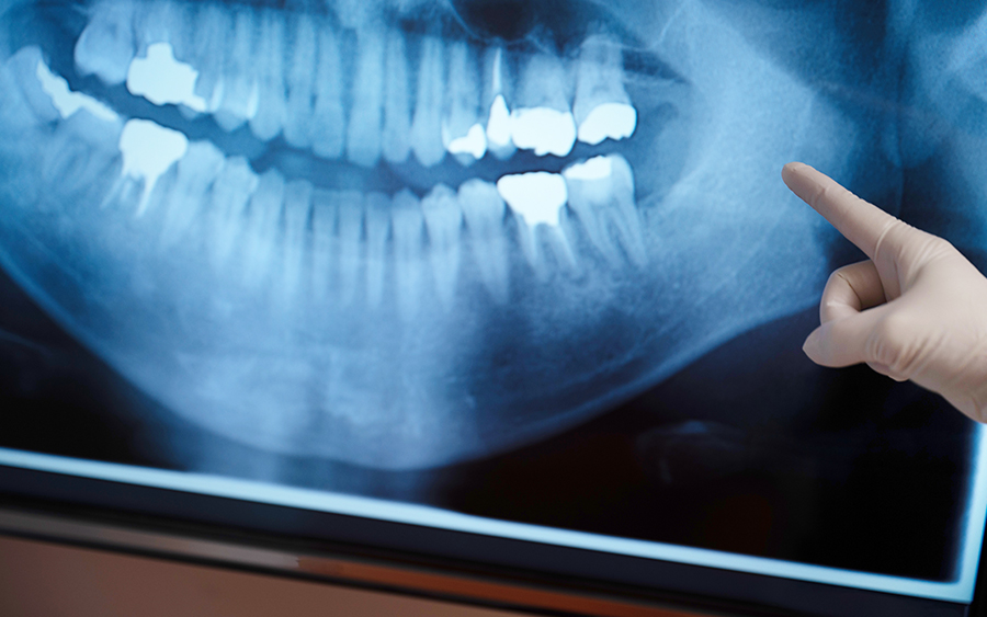 診療の流れ04_治療計画の説明