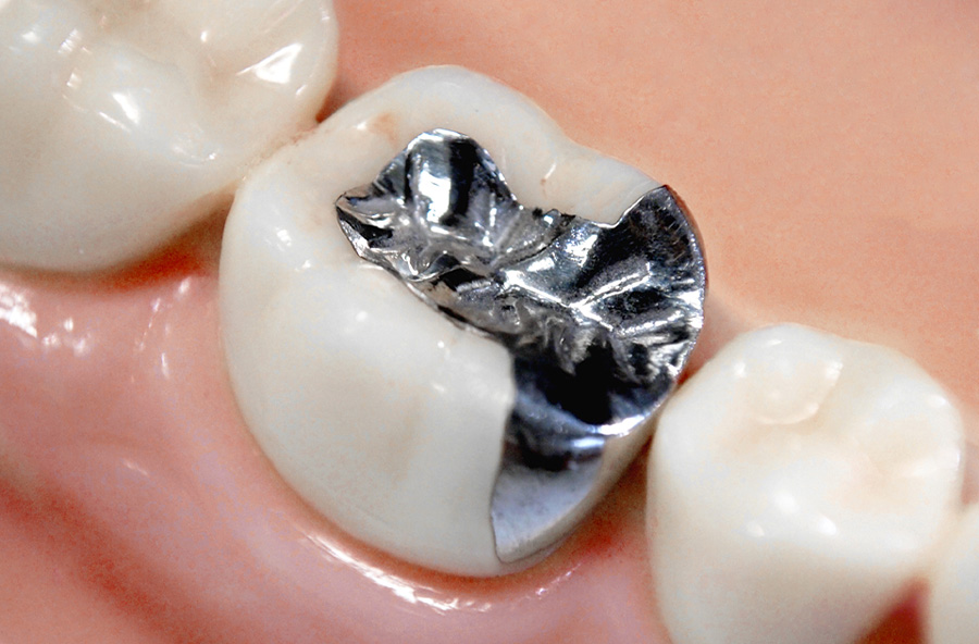 審美治療｜茨木市郡の歯科・歯医者｜ゴトウデンタルクリニック