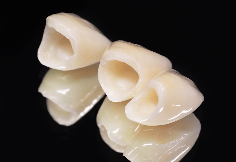 自由診療の種類01_オールセラミック