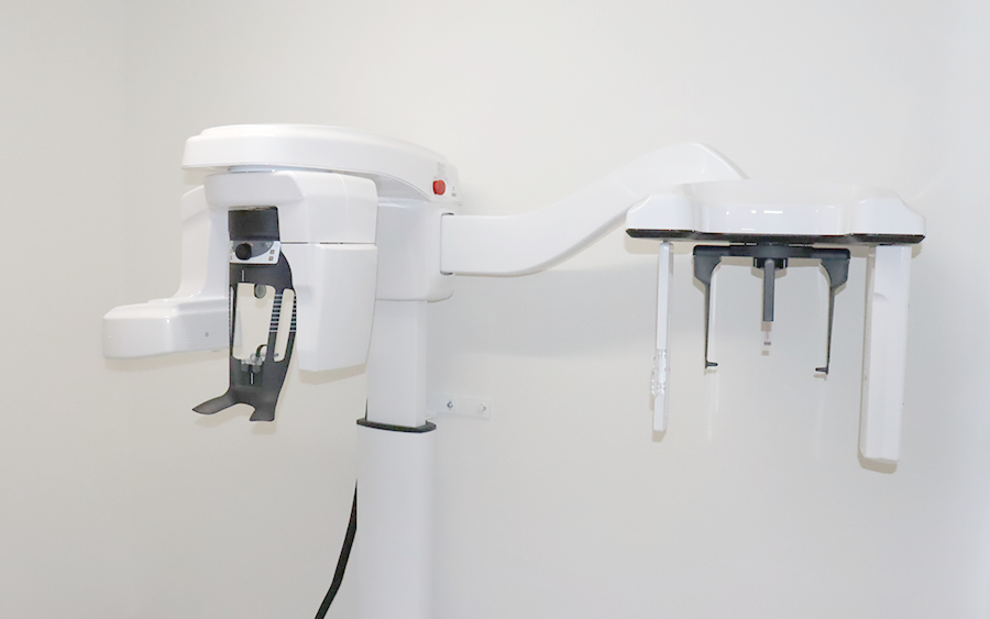 インプラント治療の流れ01_初診検査とカウンセリング