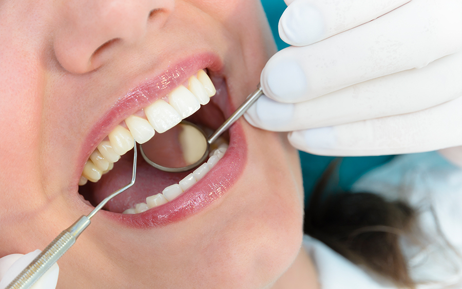 インプラント治療の流れ02_初期治療