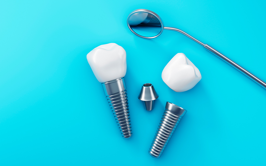 なぜメンテナンスが大切なのか02_変色や割れなどのトラブルを防ぐ