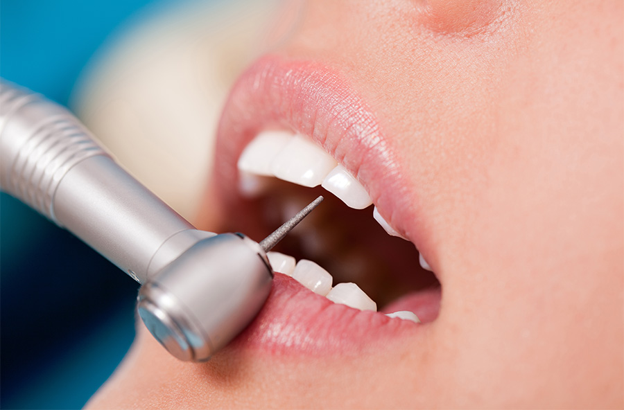 訪問歯科診療でできること01_むし歯や歯周病の治療